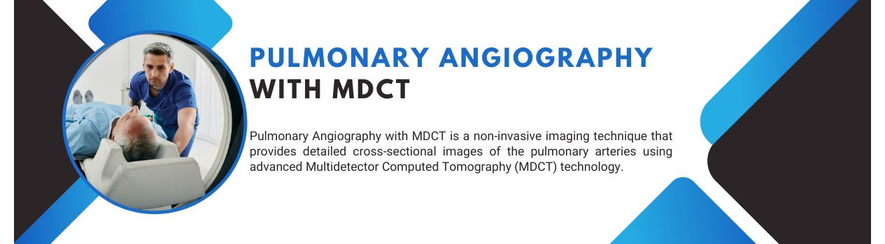 Pulmonary Angiography with MDCT